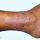 Illustration for article titled obat kadas alami